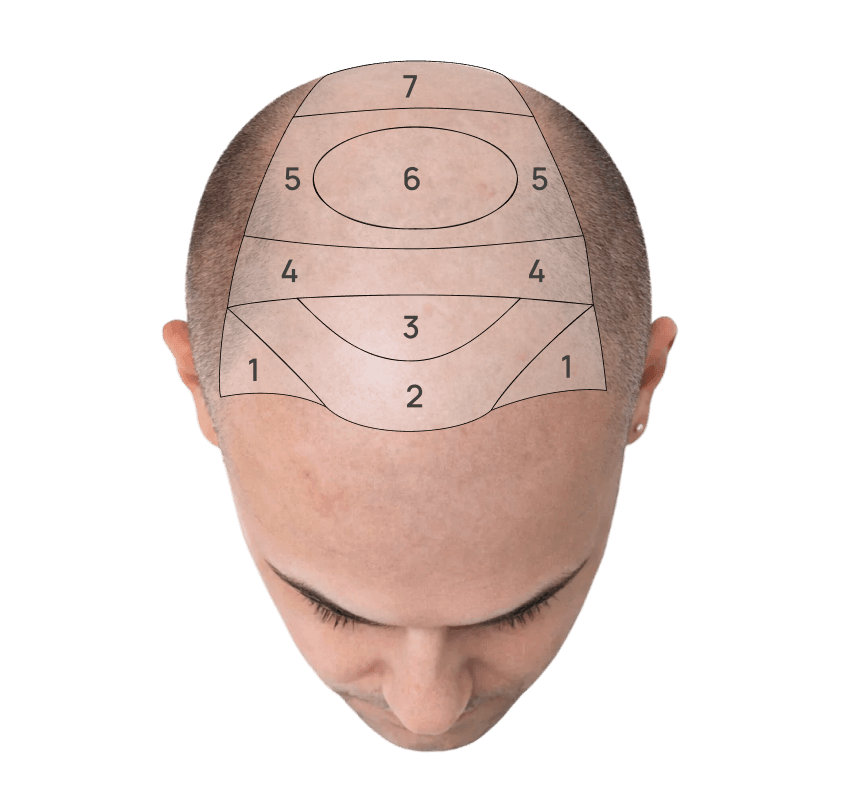Top Head