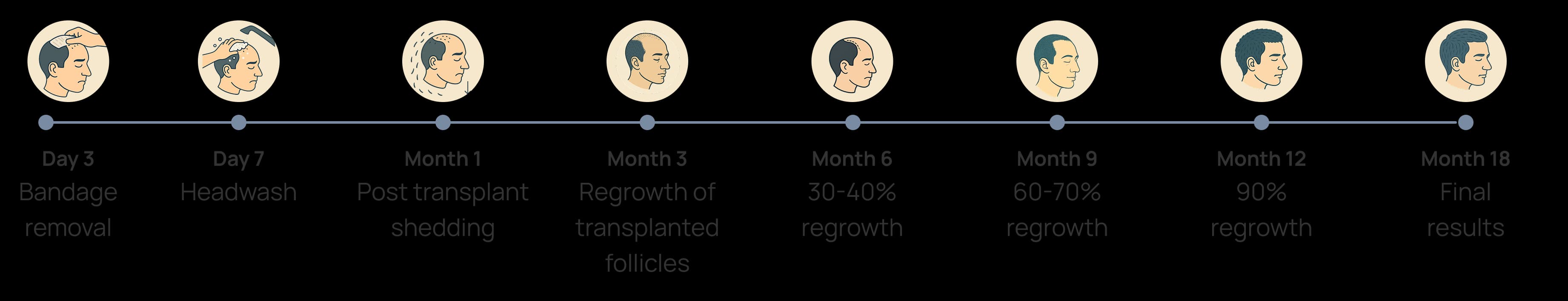 transplant timeline